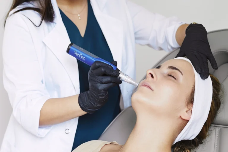 Co&nbsp;daje mezoterapia mikroigłowa? Poznaj SkinPen
